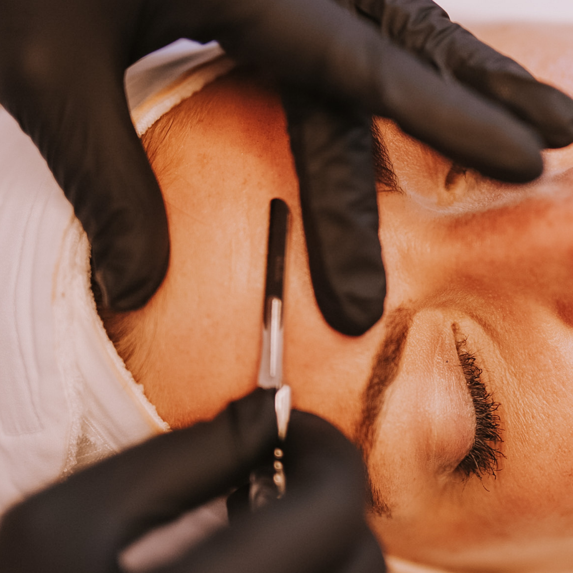 A close-up image of a person receiving a dermaplaning treatment at Kate O&