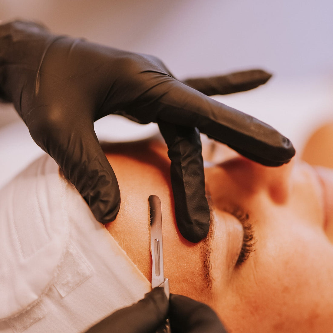 Person receiving a facial treatment with gloved hands using a dermaplaning tool.